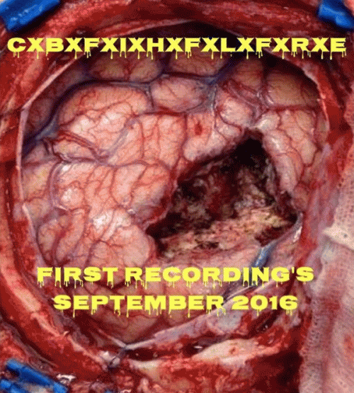 Catastrophic Blunt Force Intracranial Haemorrhage Fluid Leaking From Ruptured Eardrums : Demo Sep 2016